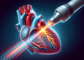 Menos riesgos en el tratamiento de la fibrilación auricular gracias a una nueva terapia